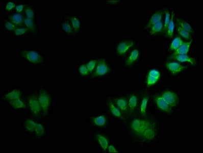 IHC-plus™ CSNK2A2 Antibody