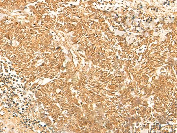 KRT76 / Keratin 76 Antibody