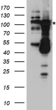 Polyclonal Rabbit anti-Human DNMT3B Antibody (WB)