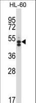 Polyclonal Rabbit anti-Human HDAC7 Antibody (aa846-875, IHC, WB)
