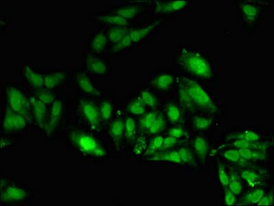 Polyclonal Rabbit anti-Human SETD5 Antibody