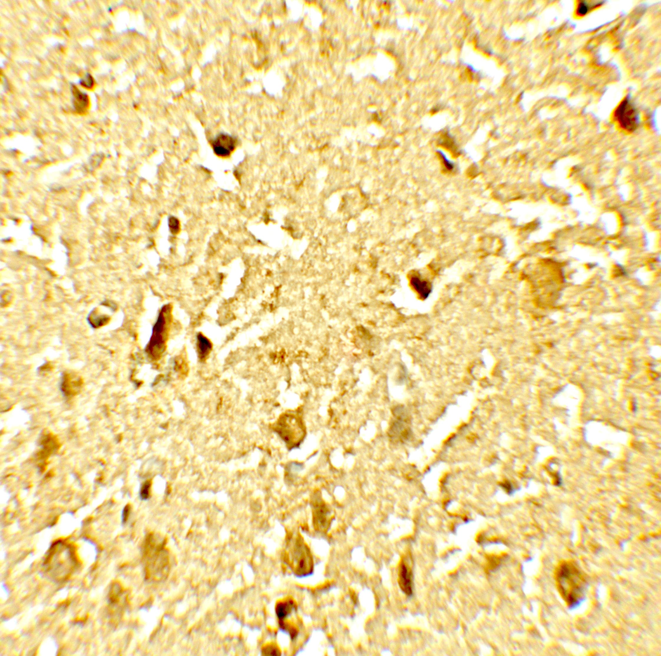 SAMHD1 Antibody (phospho-Thr592)