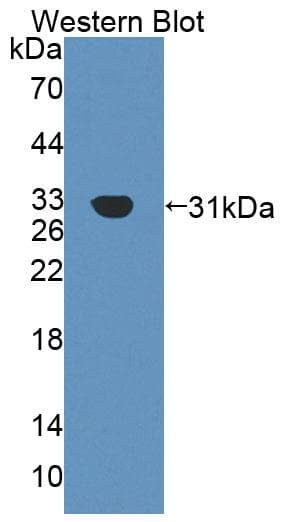 AGRN / Agrin Antibody