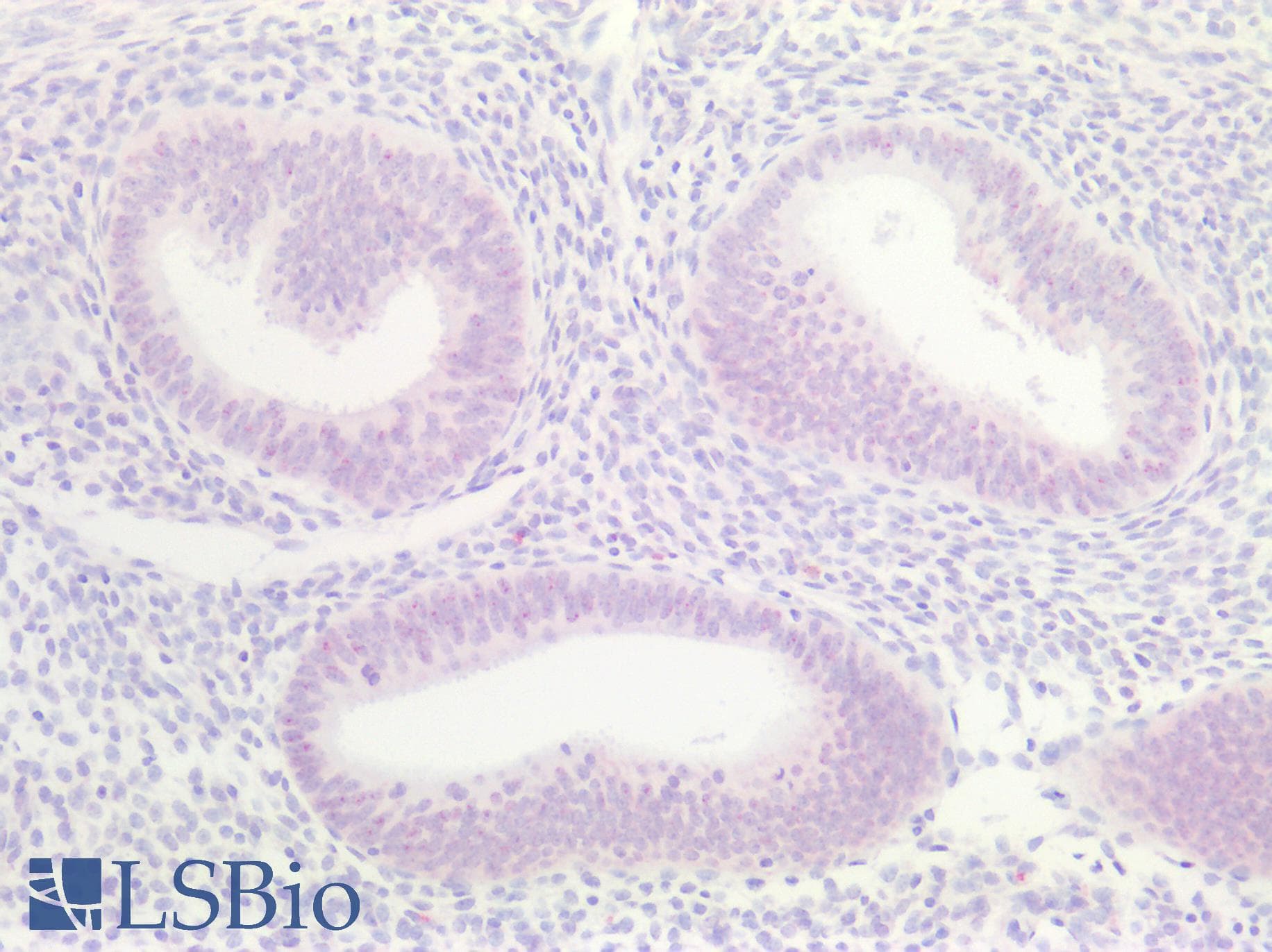 PathPlus™ MEN1 / Menin Antibody (aa575-C-term)