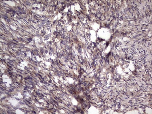 BFSP2 Antibody (aa184-415, clone OTI4E7, Carrier-free)