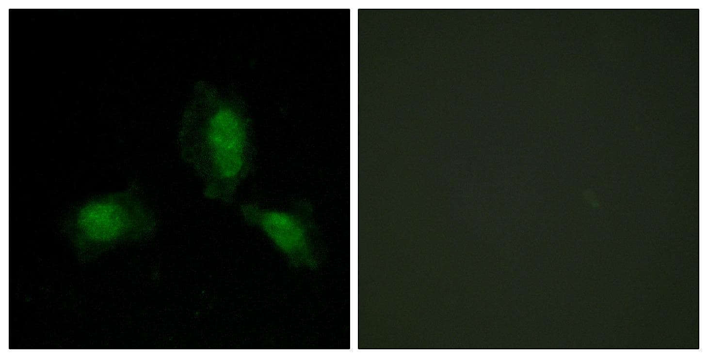 Polyclonal Rabbit anti-Human IRS1 Antibody (p312, IHC, IF, WB)