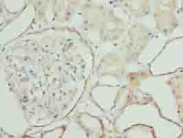 Polyclonal Rabbit anti-Human ZNF563 Antibody (IHC, WB)