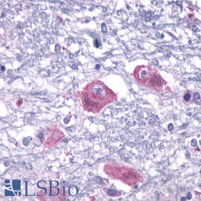 IHC-plus™ PTHR2 / PTH2R Antibody (Extracellular Domain)