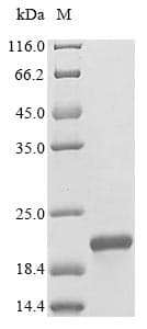 Insulin 1 [Rattus norvegicus] Protein (Recombinant 6His-SUMO, N-terminus)