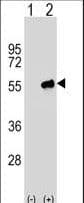 PACSIN3 Antibody (aa1-30)