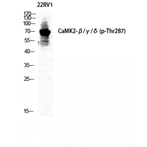 CaMKII Beta+Gamma+Delta Antibody (230-310 aa)
