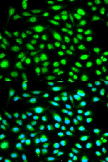 CCNH / Cyclin H Antibody
