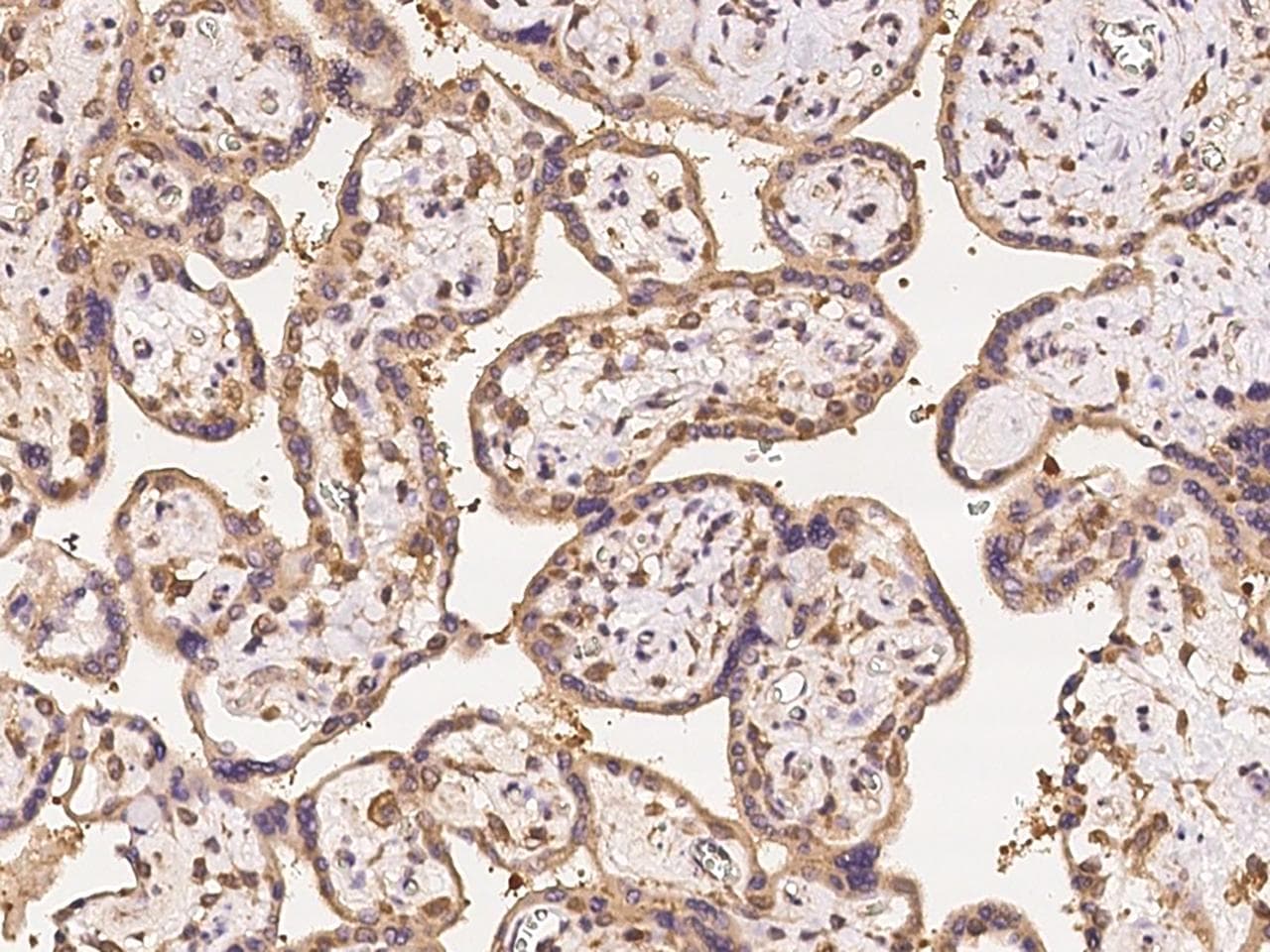 Polyclonal Rabbit anti-Human TARBP2 / TRBP2 Antibody (IHC)