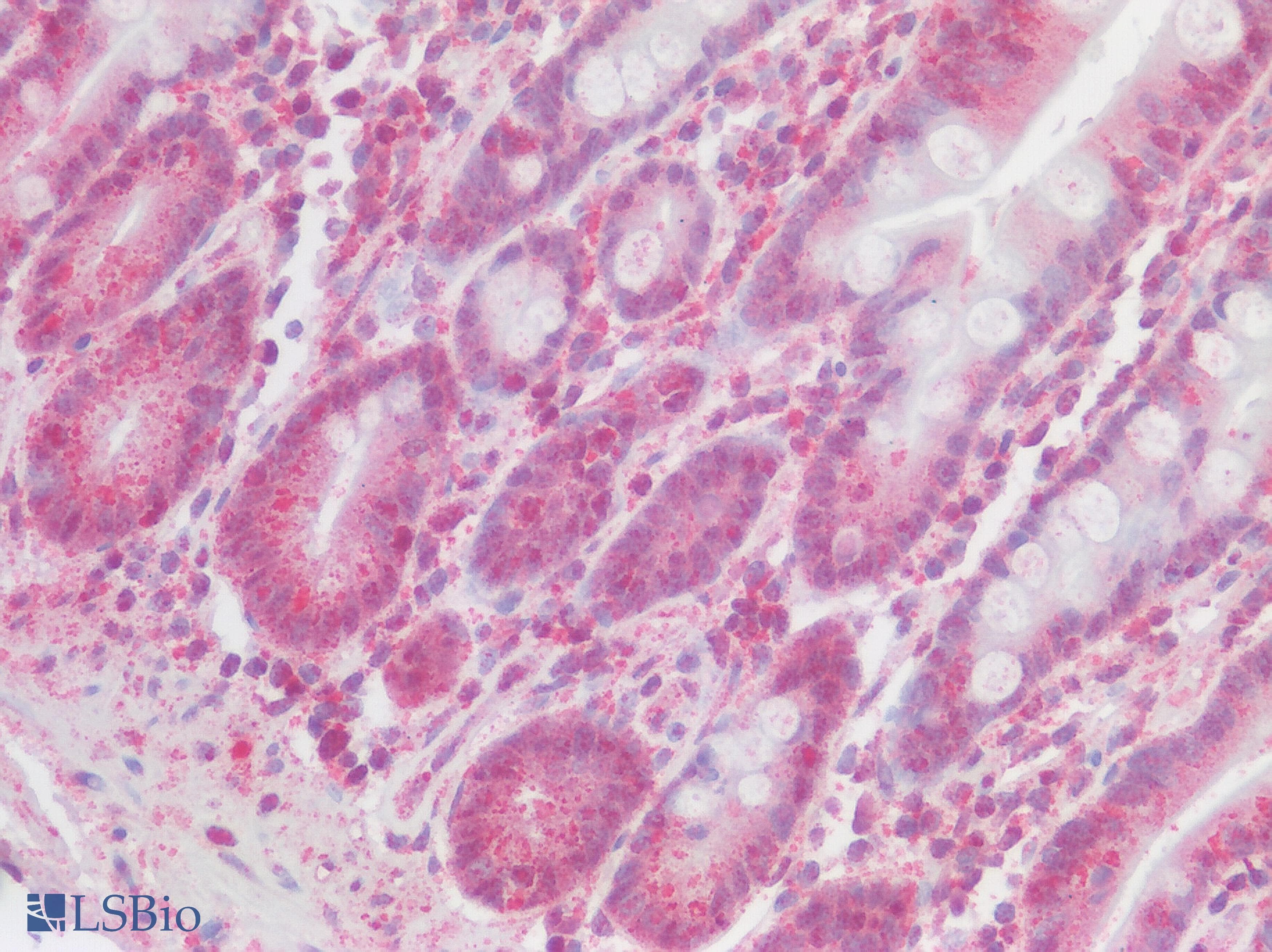 IHC-plus™ SSTR2 Antibody (Extracellular Domain)
