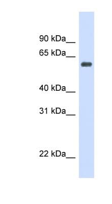 CAT / Catalase Antibody (C-Terminus)