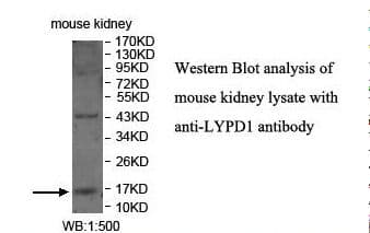 LYPD1 Antibody (aa22-71)