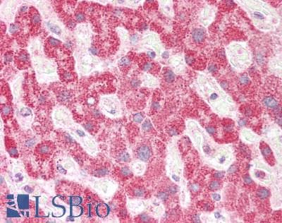 IHC-plus™ Polyclonal Rabbit anti-Human SCA2 / LY6E Antibody (IHC, WB)