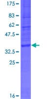 Human WDR82 / TMEM113 Protein (Recombinant GST)