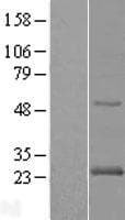 RAB24 Protein (Over-Expression Lysate Myc-DDK (Flag))
