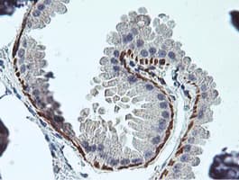 RFXANK Antibody (clone OTI3F5)