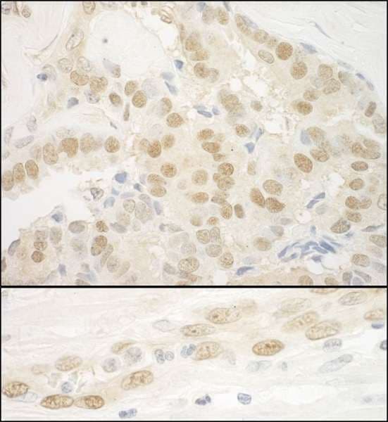 MKL2 Antibody (aa1038-1088)