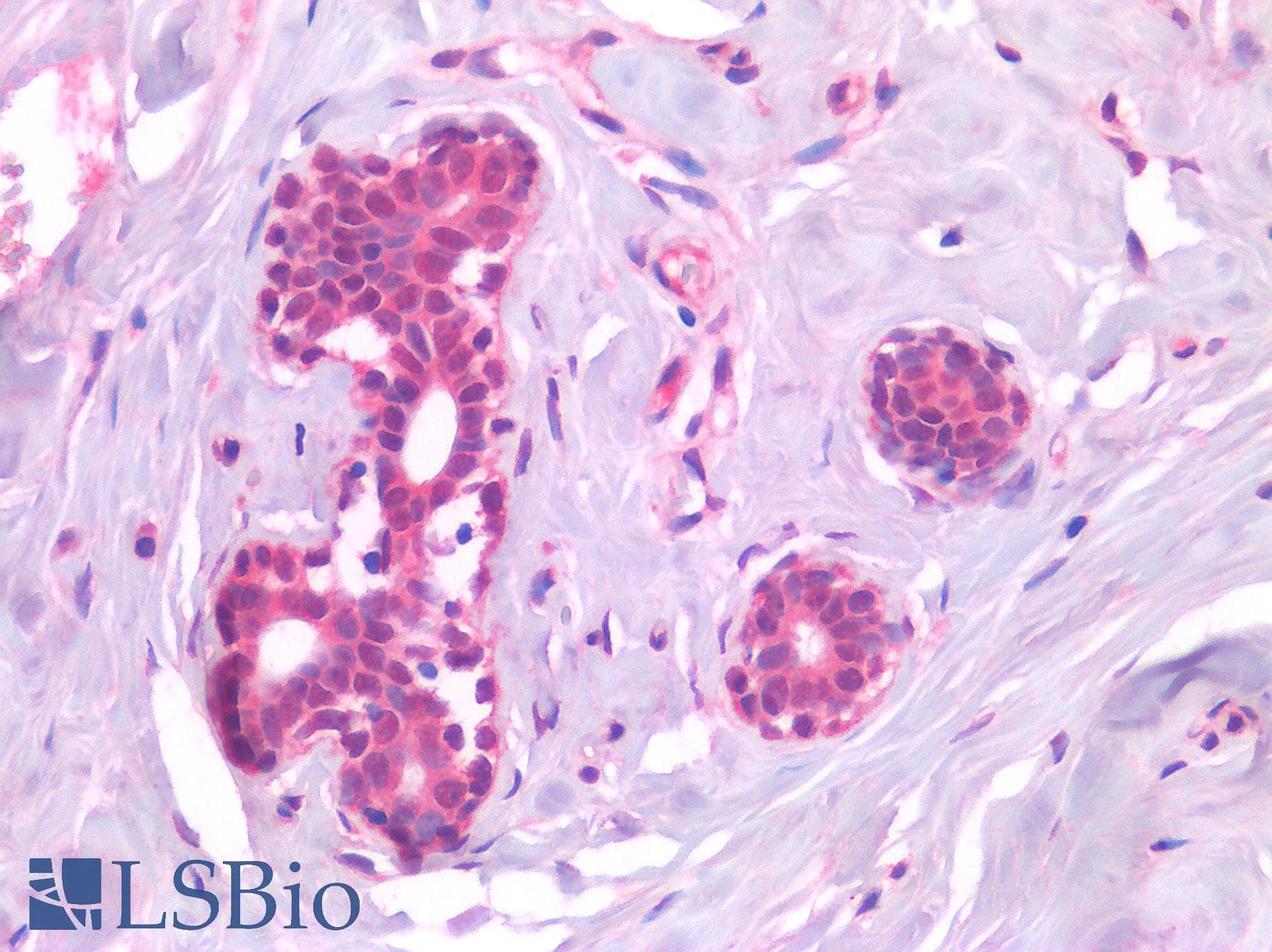 IHC-plus™ Polyclonal Rabbit anti-Human AML1 / RUNX1 Antibody (IHC)