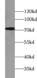 Polyclonal Rabbit anti-Human BTN1A1 Antibody (WB)