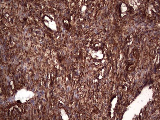 PKM2 Antibody (clone OTI12D5, Carrier-free)