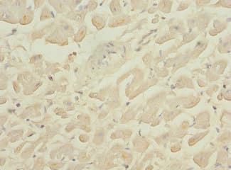 GALNT2 Antibody