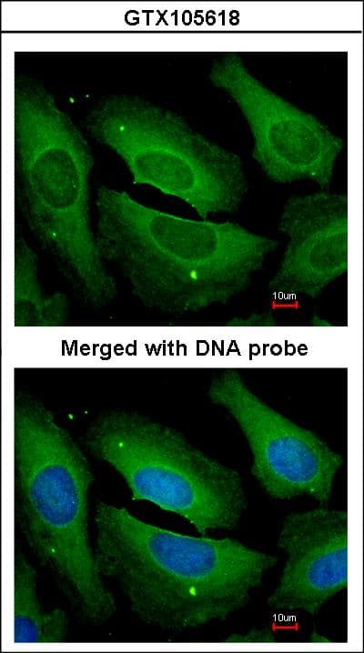 PPP1CC / PP1 Gamma Antibody (aa2-227)