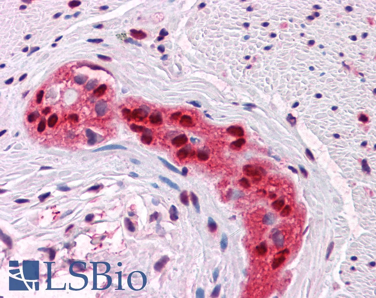 IHC-plus™ SOX9 Antibody (clone 3C10)