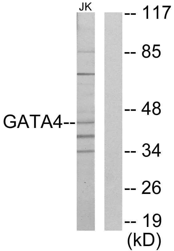 GATA4 Antibody (aa271-320)