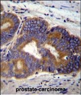 TUBB8P12 / Tubulin beta-8 Antibody (aa 253-280, C-term)