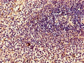 MYL2 Antibody