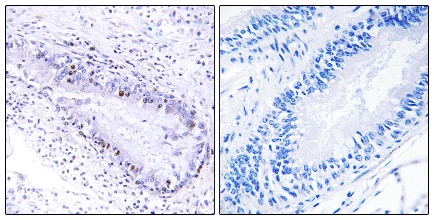 Polyclonal Rabbit anti-Human TP1 / TEP1 Antibody (IHC)