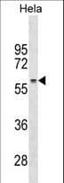RRP1 Antibody (aa298-326)