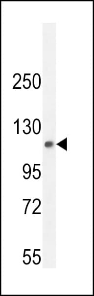 Polyclonal Rabbit anti-Human PHF12 Antibody (aa831-859, IHC, WB)