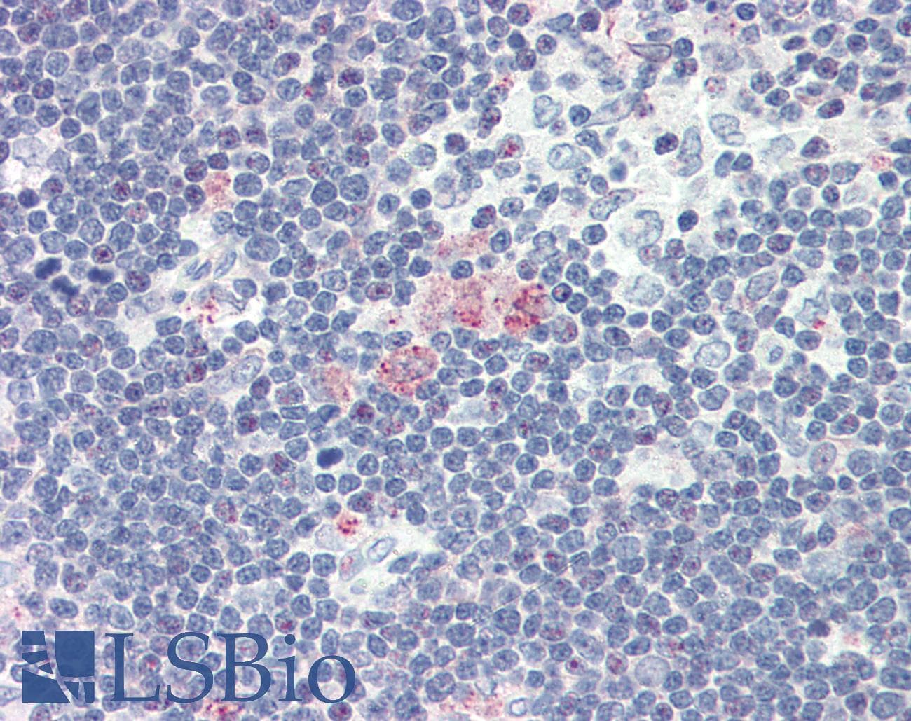 IHC-plus™ SDF1 / CXCL12 Antibody