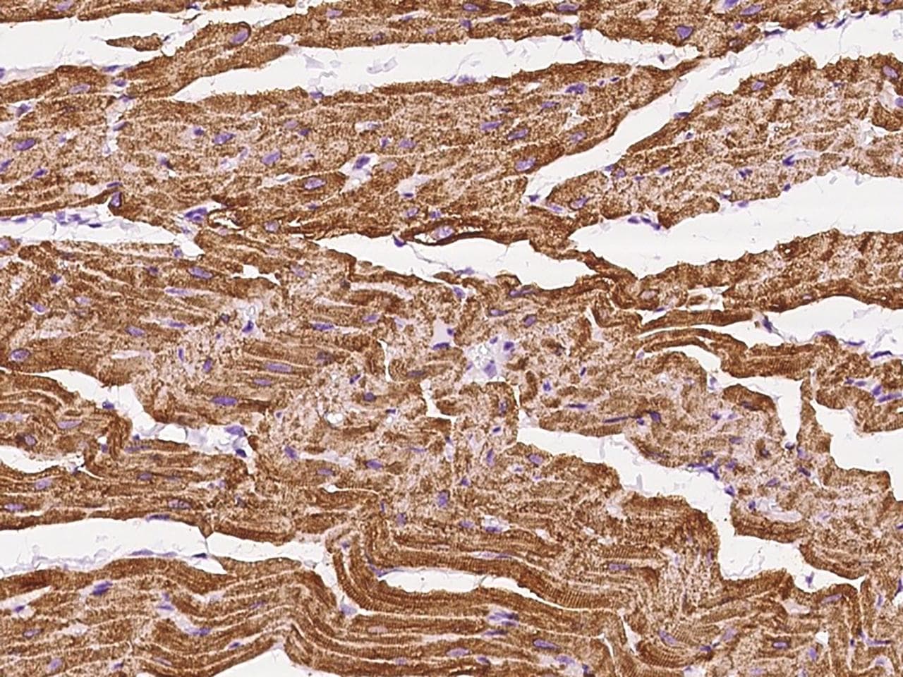 Polyclonal Rabbit anti-Human ATP2A2 / SERCA2 Antibody (IHC)