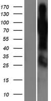 SHQ1 Protein (Over-Expression Lysate Myc-DDK (Flag))