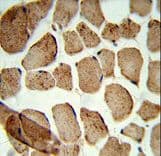 ULK1 Antibody