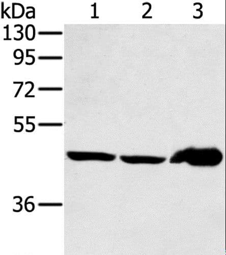 Polyclonal Rabbit anti-Human SEC14L2 Antibody (IHC, WB)