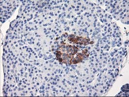 ACSS2 / ACAS2 Antibody (clone OTI3B12)