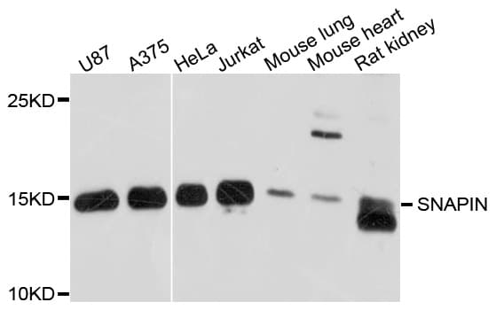 Polyclonal Rabbit anti-Human SNAPIN Antibody (WB)