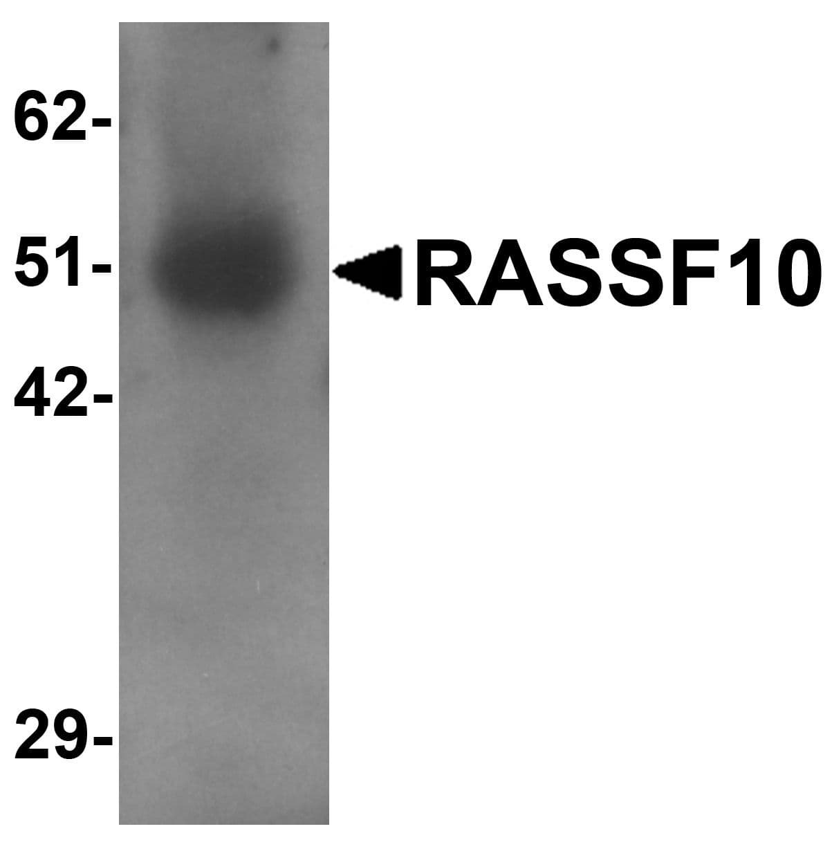 IHC-plus™ RASSF10 Antibody