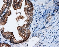 Monoclonal Mouse anti-Human RIP1 / RALBP1 Antibody (clone OTI1E2, IHC, IF, WB)