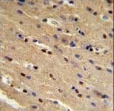 Polyclonal Rabbit anti-Human TP73 / p73 Antibody (aa288-317, IHC, IF, WB)