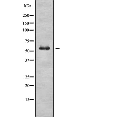GBA / Glucosidase Beta Acid Antibody