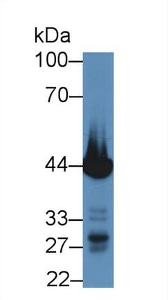 TNNT2 / CTNT Antibody (aa56-271, PE)