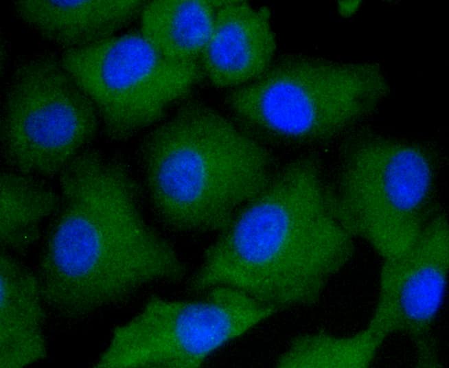 ARRB1 / Beta Arrestin 1 Antibody